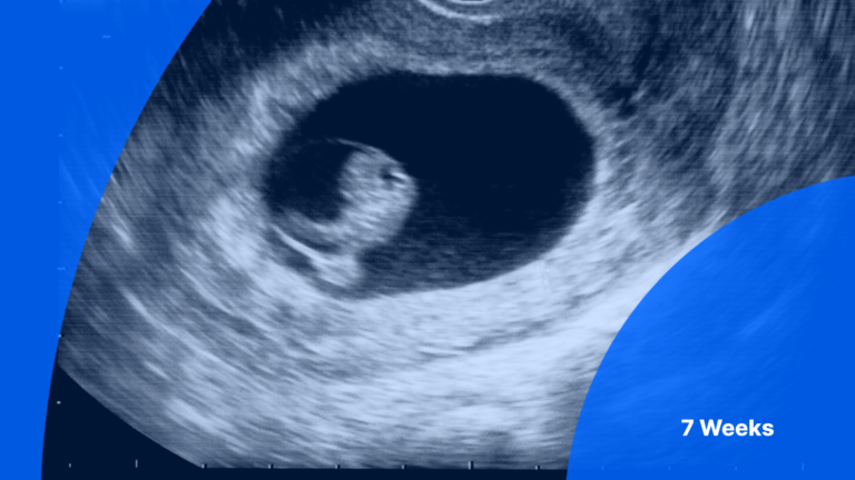 7 Weeks Pregnant Ultrasound Photos: A Comprehensive Guide
