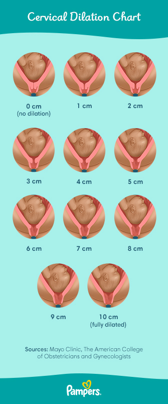 Checking Cervical Dilation At Home: A Comprehensive Guide