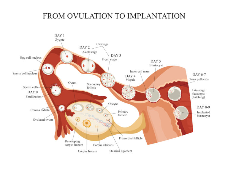 How Long Can Implantation Take: A Comprehensive Guide to Understanding the Process