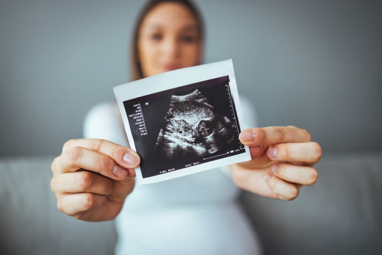 How Many Usg During Pregnancy: A Comprehensive Guide