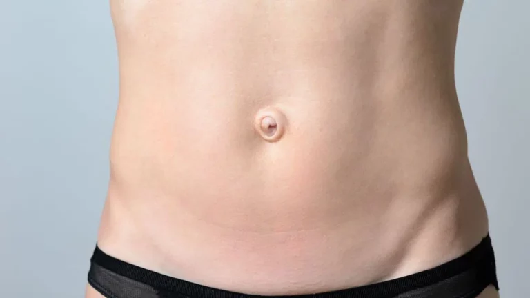 Innie Or Outie Belly Button: A Comprehensive Guide to Belly Button Anatomy, Medical Conditions, and Cultural Significance