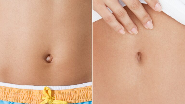Innie or Outie Belly Button: Unveiling the Secrets of Our Navels