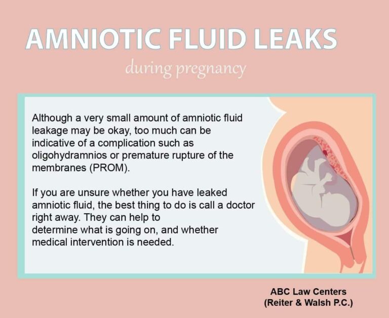 Leakage of Amniotic Fluid: Causes, Symptoms, and Treatment