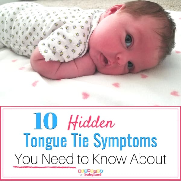 10 Hidden Tongue Tie Symptoms You Need To Know About Blunders In Babyland