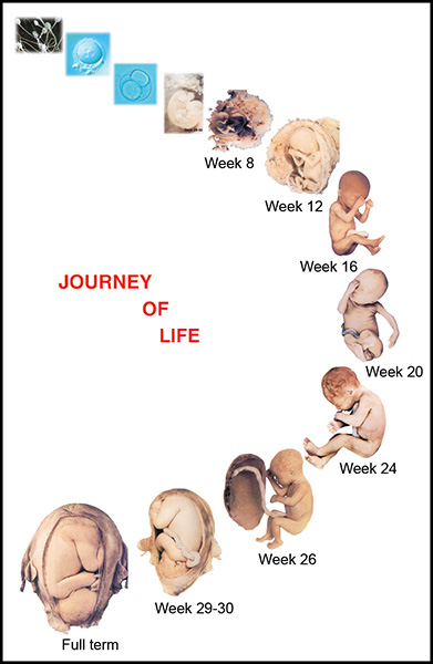 29 Weeks Fetus
