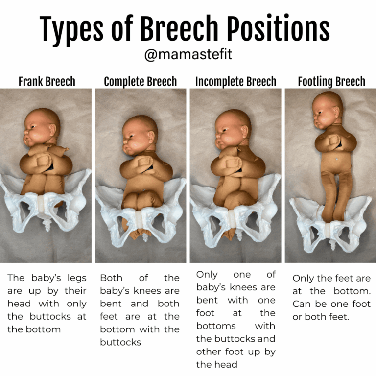 4 Exercises To Flip Your Breech Baby Head Down MamasteFit