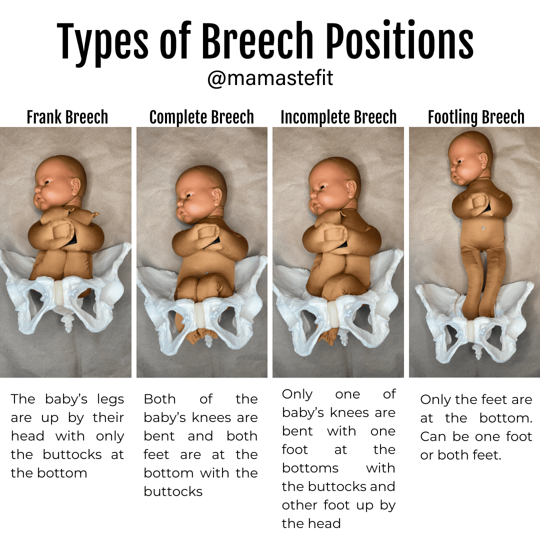 4 Exercises To Flip Your Breech Baby Head Down MamasteFit