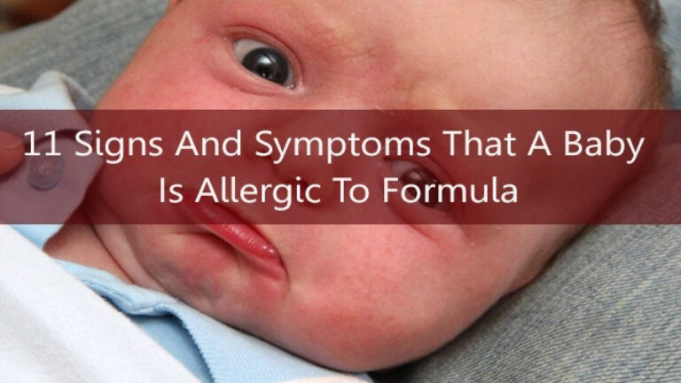 44 Allergic Reaction To Baby Formula PNG