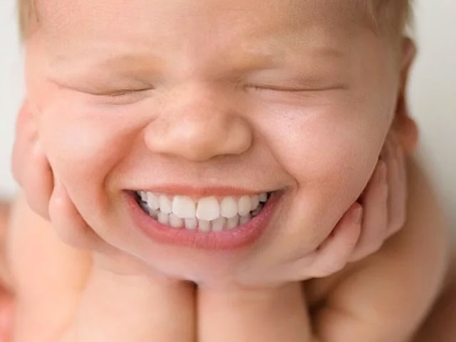BABIES BORN WITH TEETH Dr Dunne Eugene Dentist Pediatric 