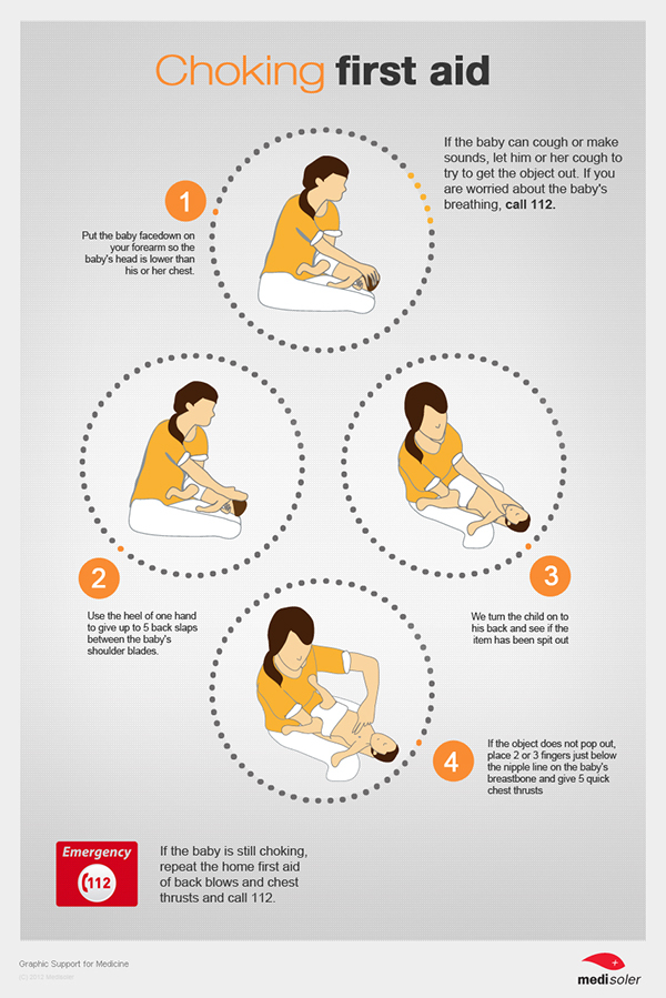 Baby Choking First Aid Print Design On Behance