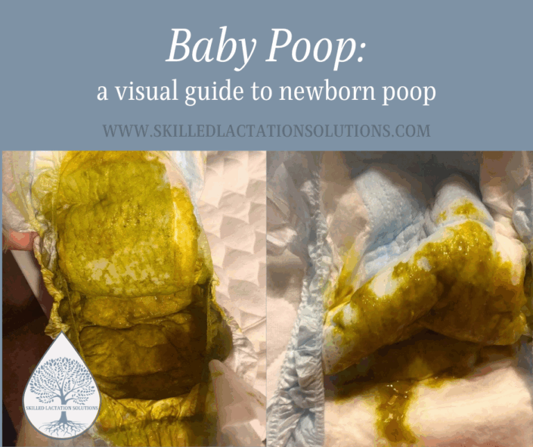Baby Poop A Visual Guide To Newborn Poop