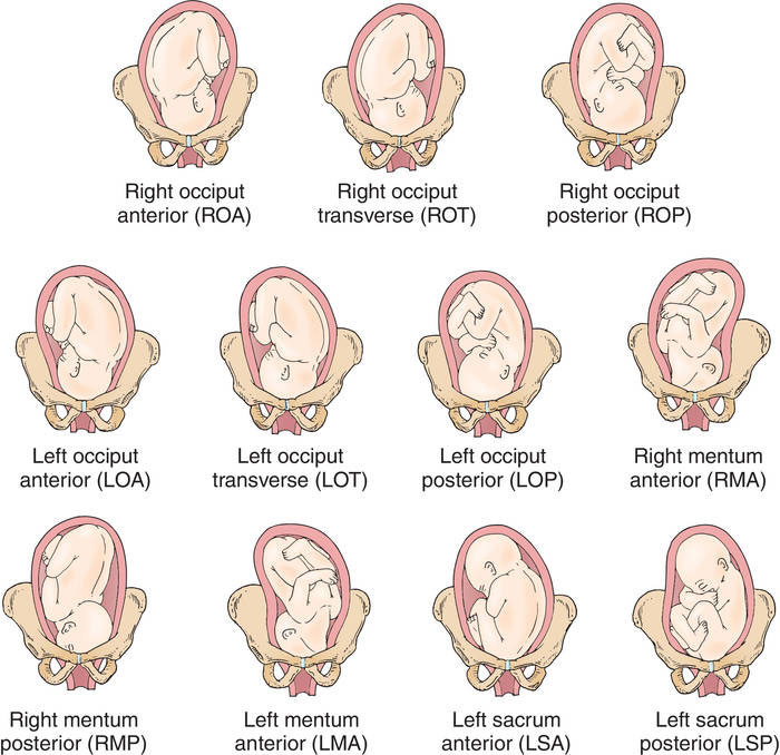 Baby Positions Before Birth Explained Lovem re 58 OFF