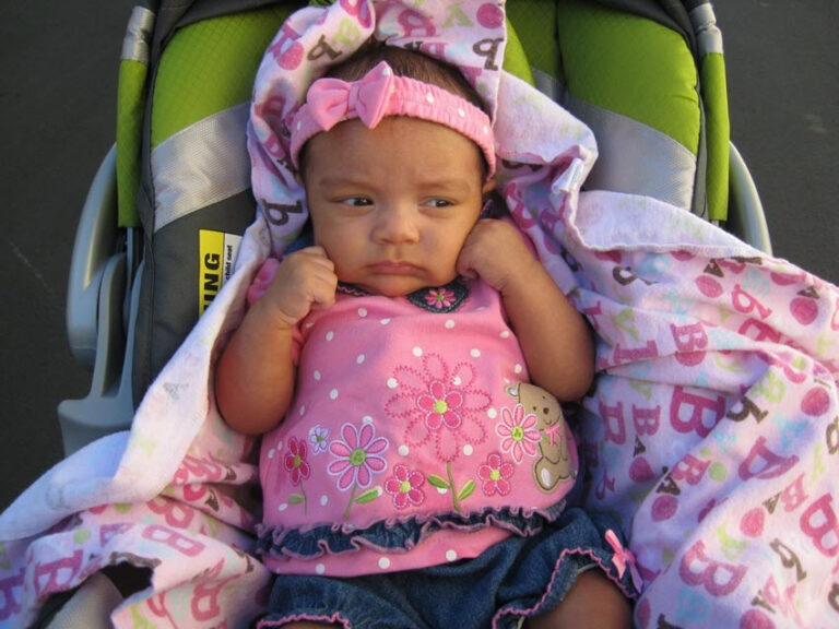 Baby Skin Color Changing MomInformed Resources For Parents