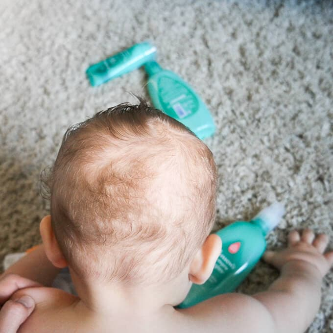 Battling The Baby Bald Spot