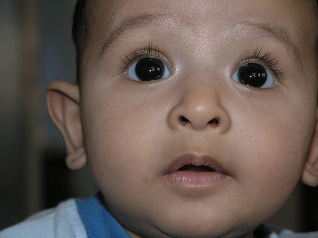 Blindness At Birth However Brief Has Lifelong Impact On The Brain 