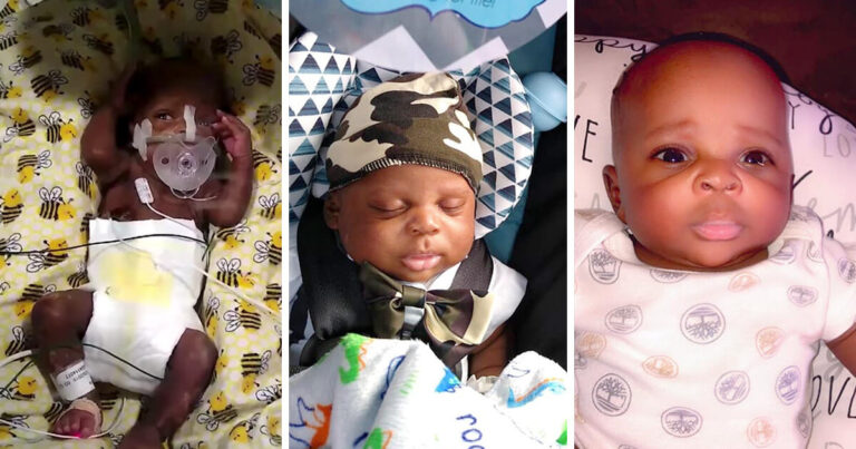 Born At Just 21 Weeks One Of The World 39 s Youngest Surviving Premature 