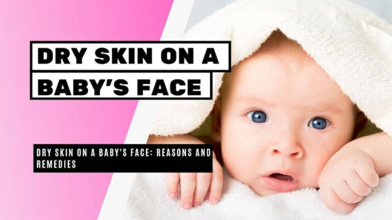 Dry Skin On Baby Face Reasons And Remedies Bright Freak Dry Skin 