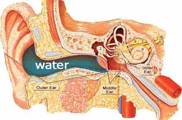 Ear water Natural Treatment For Tinnitus