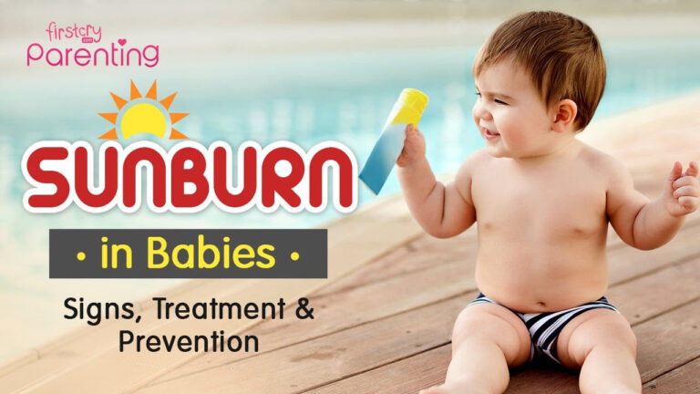 Easy Tips Precautions For Baby Sunburn YouTube