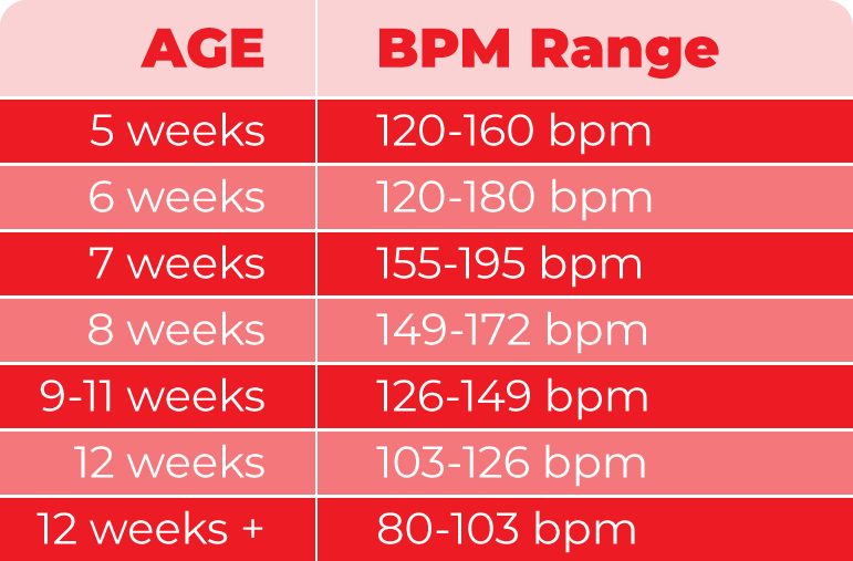 Fetal Heart Rate Monitoring Explained CardiacDirect