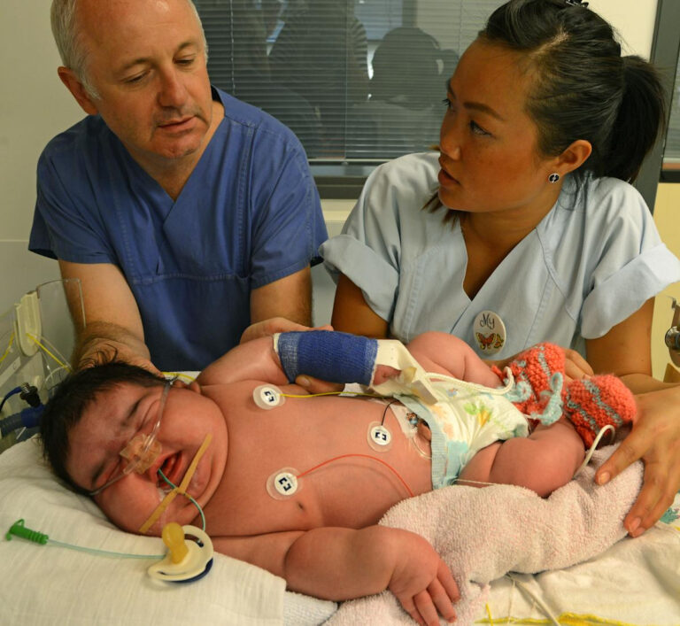 Germany s Largest Ever Baby Born At More Than 13 Pounds