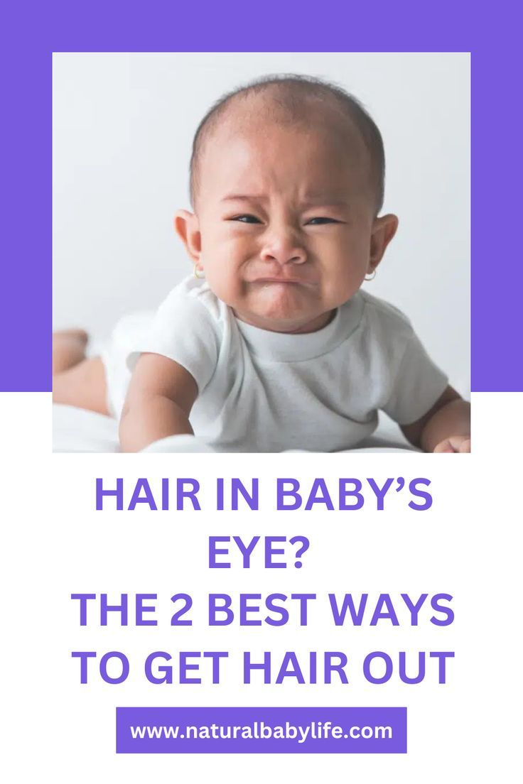 Hair In Baby S Eye The 2 Best Ways To Get Hair Out Artofit