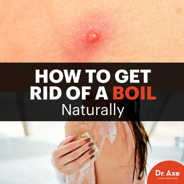 Hot To Get Rid Of A Boil How To Prevent Boils Dr Axe