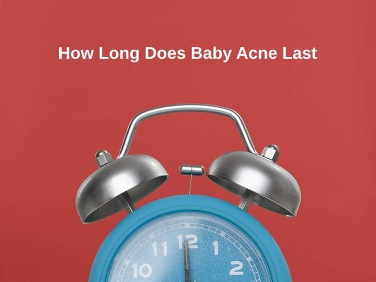 How Long Does Baby Acne Last And Why 