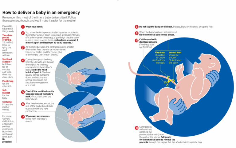 How To Deliver A Baby In An Emergency totally Got To Use These Skills 