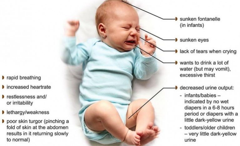 How To Spot Dehydration In Babies First Aid For Free