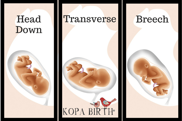 How To Tell If Baby Is Head Down Kopa Birth 