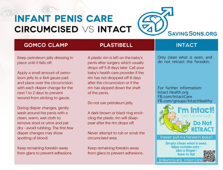 Peaceful Parenting Basic Care Of The Intact Child