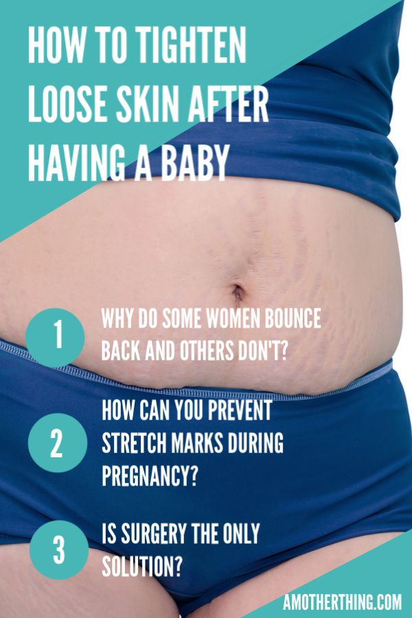 Pin On Pregnancy Maternity Tips