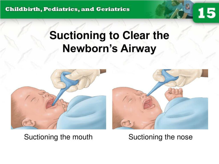 PPT Chapter 15 Childbirth PowerPoint Presentation Free Download 