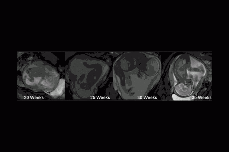 Should I Feel Baby Move At 20 Weeks Baby Tickers