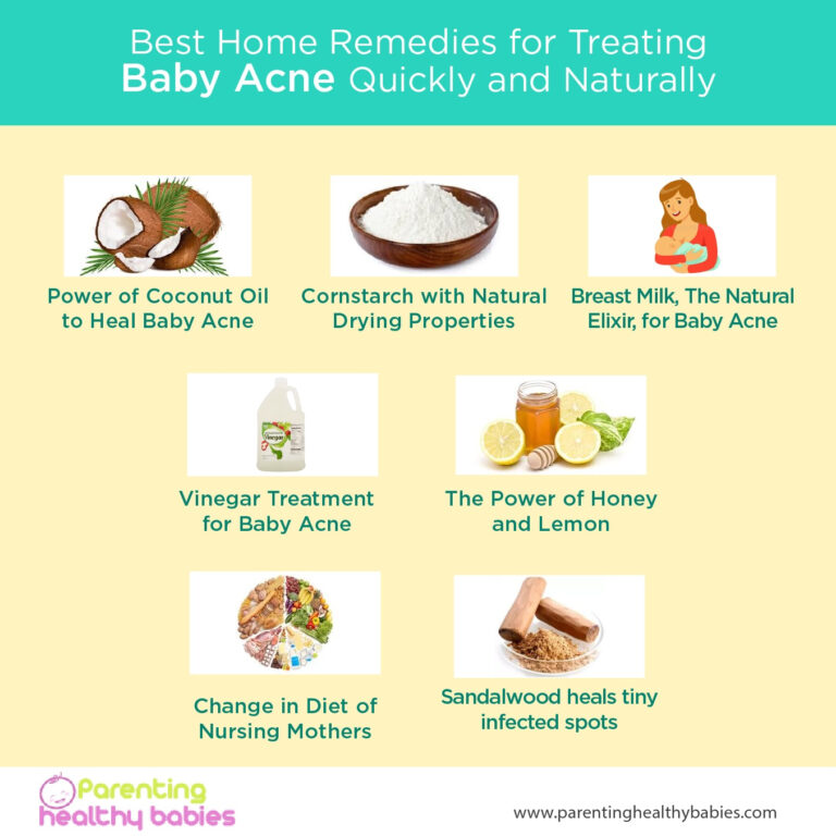 Ultimate Guide For Treating Baby Acne Naturally Home Remedies