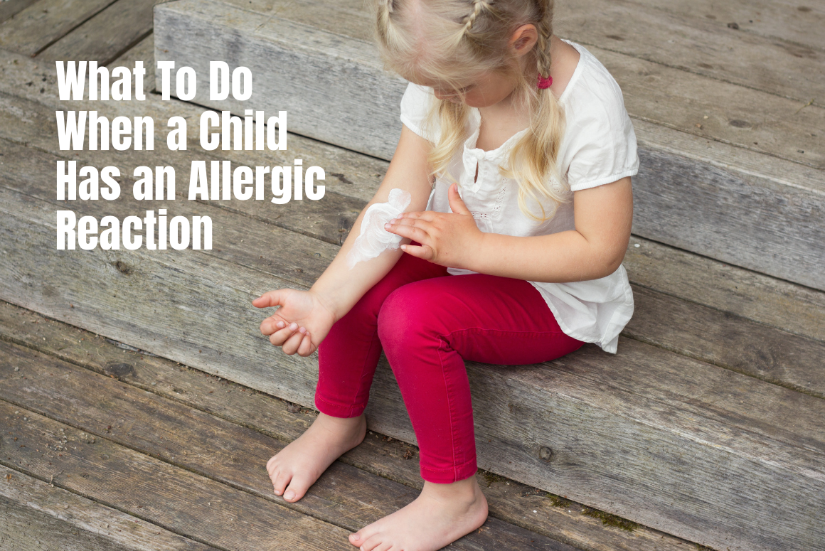 What To Do When A Child Has An Allergic Reaction EPACT