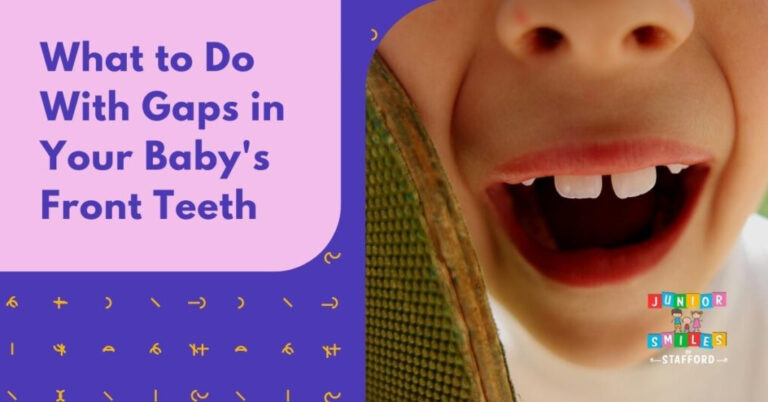What To Do With Gaps In Your Baby 39 s Front Teeth Junior Smiles Of Stafford