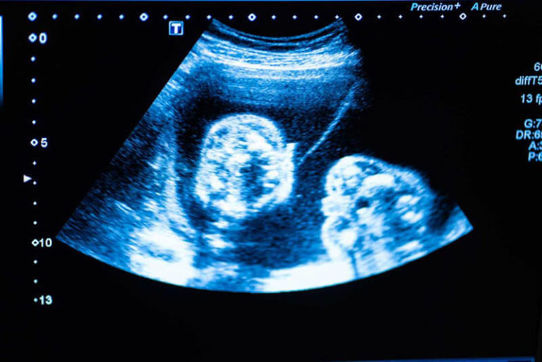 When Does A Baby Have A Heartbeat Quick And Revealing Overview 