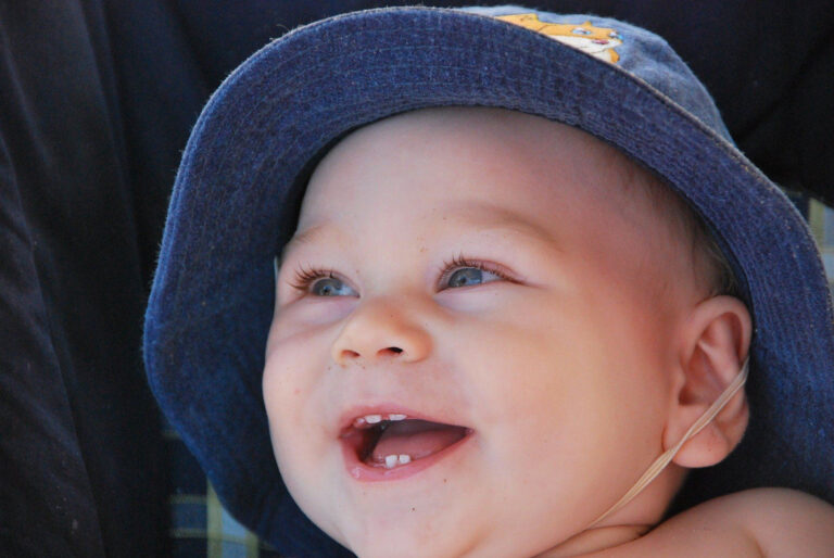 When Does Baby Get First Tooth Yoors